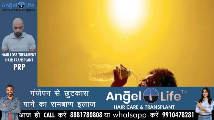 मार्च माह में बढ़ी सूरज की तपिश से अप्रैल में पड़ रही जून जैसी गर्मी