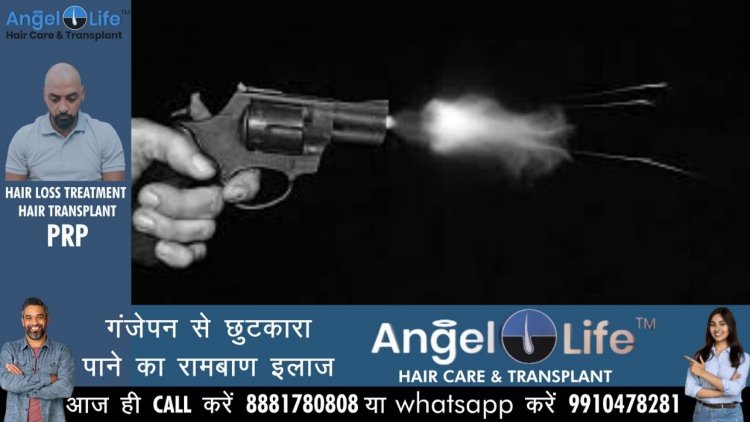 प्रयागराज: पुरानी रंजिश में युवक को मारी गोली