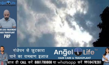 आज बदल गया मौसम का मिजाज, प्रदेश में कई जगहों पर हल्की बारिश की संभावना