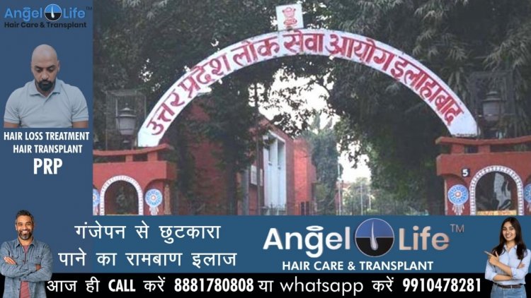 उप्र : स्टॉफ नर्स का परिणाम घोषित, 1025 अभ्यर्थी सफल