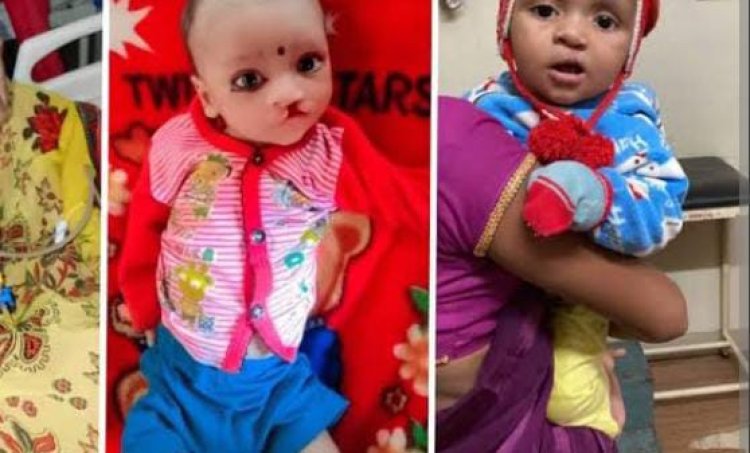 योगी सरकार श्रवण बाधित बच्चों का निशुल्क करा रही आपरेशन, मांगा आवेदन
