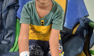 जन्मजात रेडियोउलनार सिनोस्टोसिस से पीड़ित बच्चे का एसआरएन में हुआ सफल आपरेशन