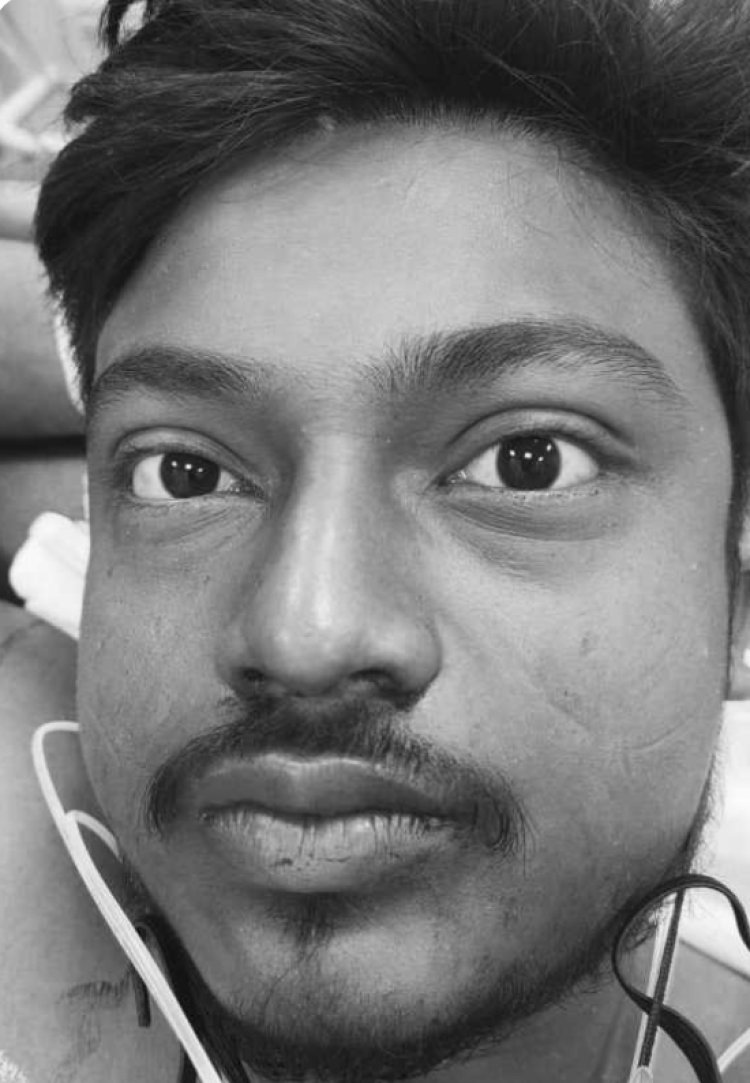 उलीडीह में बंटी कुमार को मारी गोली , रिम्स रेफर