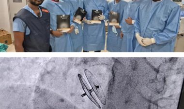 पूर्वी यूपी में पहली बार पीएफओ डिवाइस क्लोजर से क्रॉनिक माइग्रेन का सफल इलाज