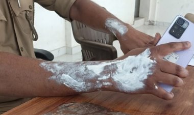 पत्नी से विवाद के बाद युवक ने थाने के बाहर खुद को लगाई आग, बचाने में थाना प्रभारी समेत तीन पुलिसकर्मी झुलसे